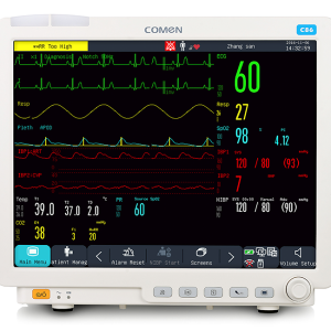 Monitores de sinais vitais
