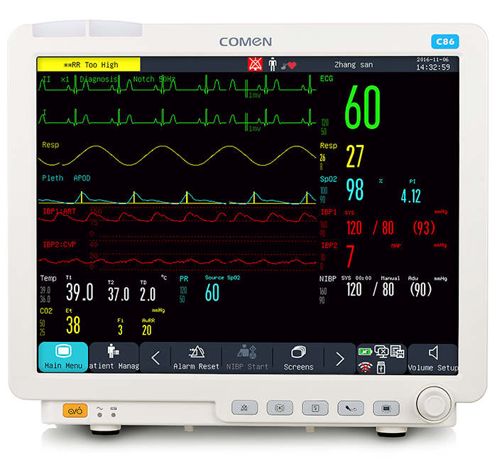 Monitores de sinais vitais